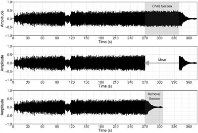 Suppressing the Chills: Effects of Musical Manipulation on the Chills Response